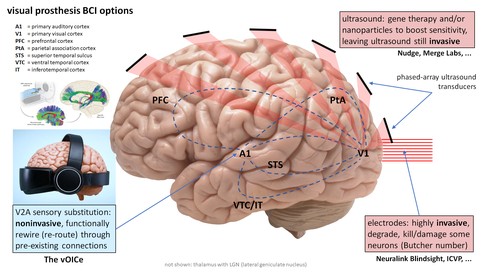 Graphical abstract of BCI options for a visual prosthesis.